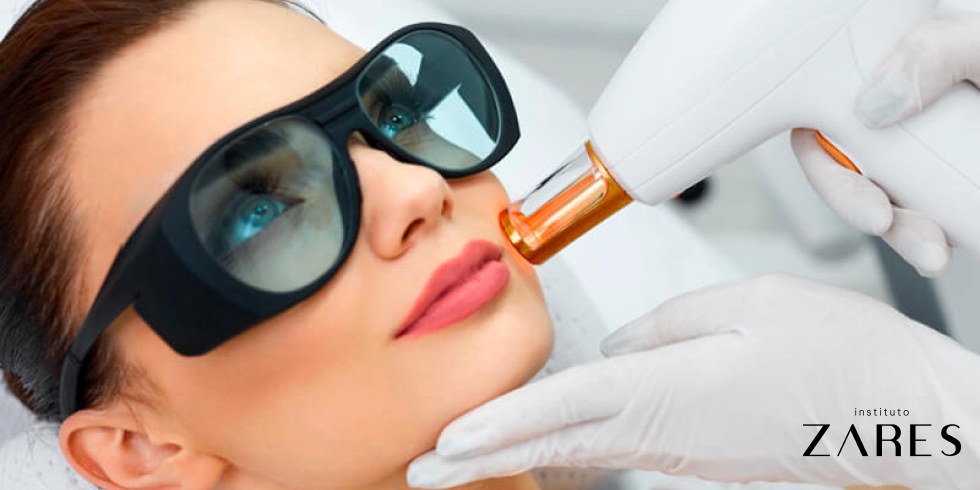 Resurfacing Facial a Laser: Benefícios Para o Rejuvenescimento
