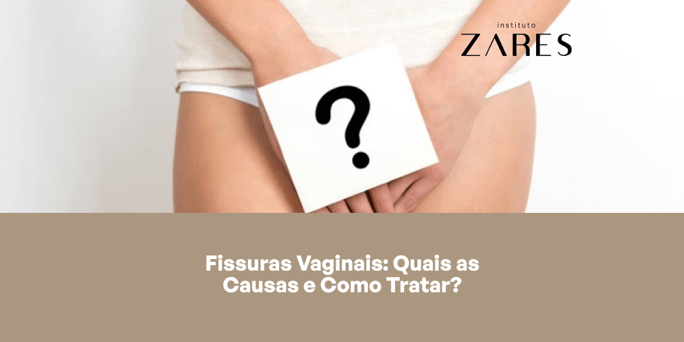 Fissuras Vaginais: Quais as Causas e Como Tratar?