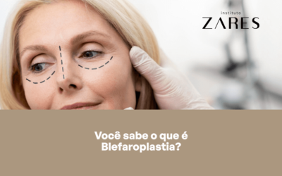 Você Sabe o Que é Blefaroplastia?